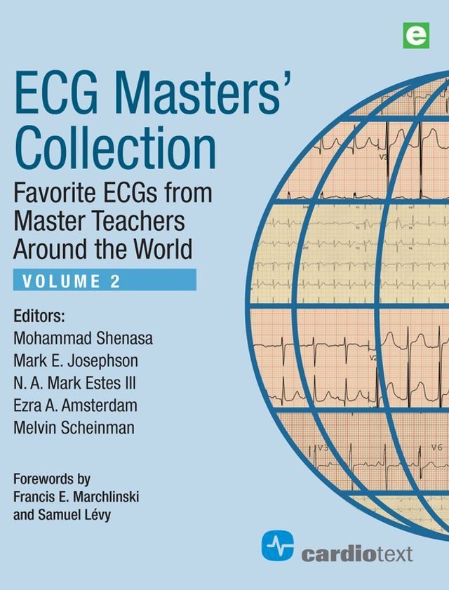  ECG Masters Collection Volume 2(Kobo/電子書)