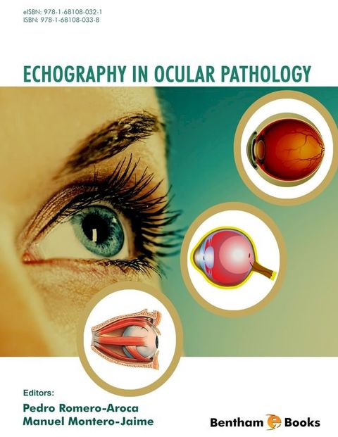 Echography in Ocular Pathology(Kobo/電子書)