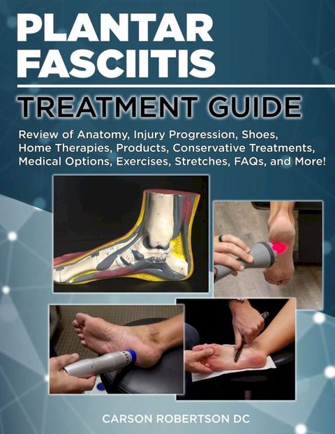 Plantar Fasciitis Treatment Guide(Kobo/電子書)