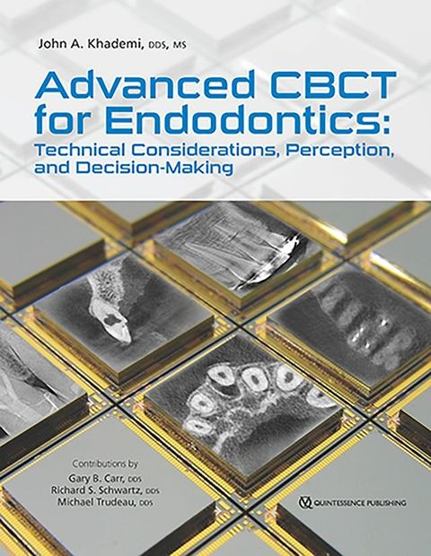 Advanced CBCT for Endodontics(Kobo/電子書)