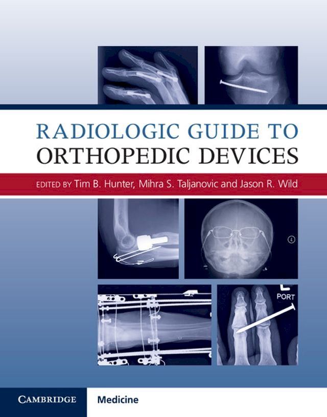  Radiologic Guide to Orthopedic Devices(Kobo/電子書)