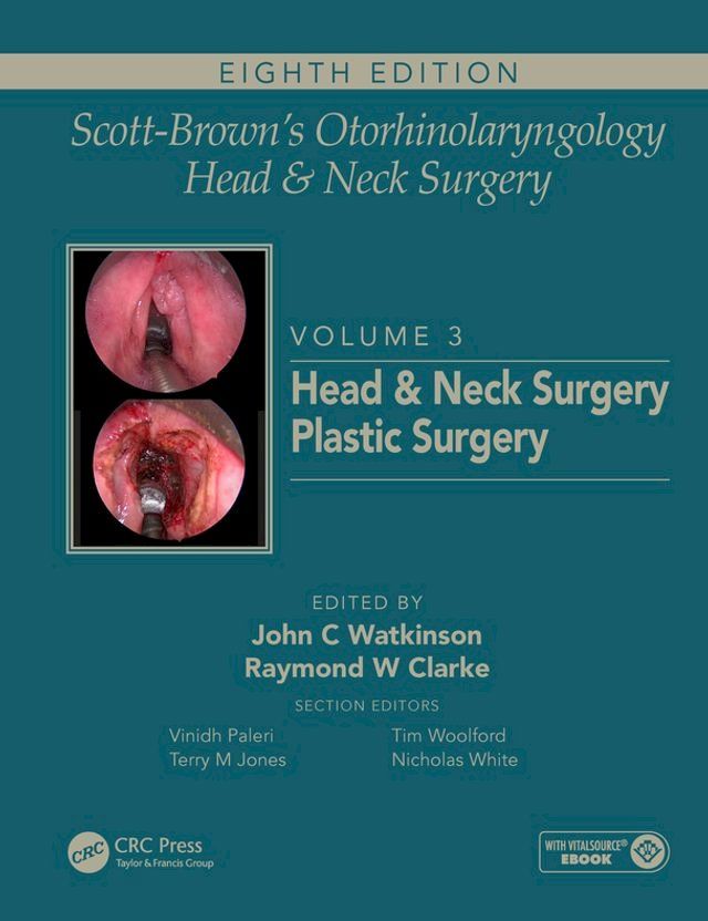  Scott-Brown's Otorhinolaryngology and Head and Neck Surgery(Kobo/電子書)