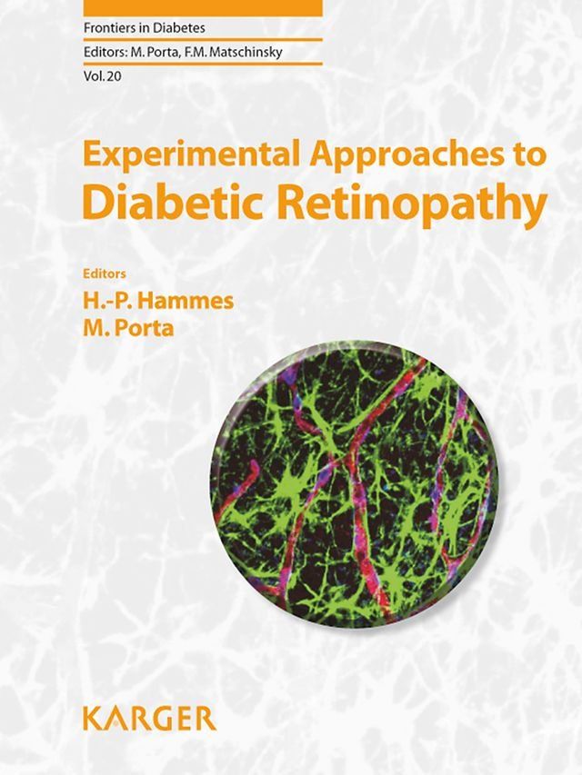  Experimental Approaches to Diabetic Retinopathy(Kobo/電子書)