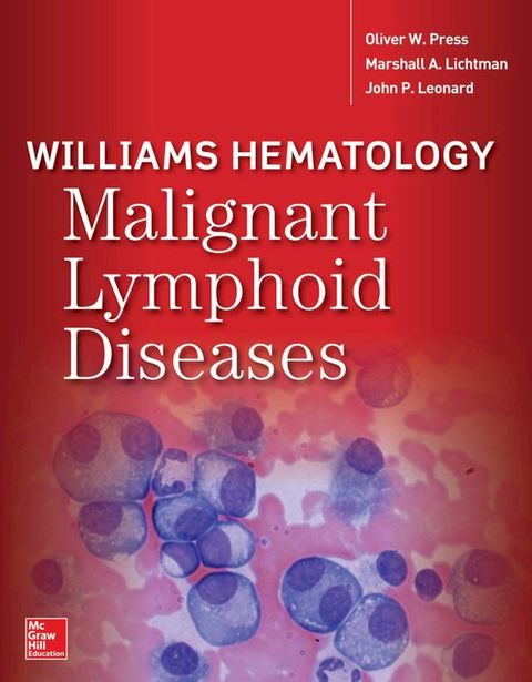 Williams Hematology Malignant Lymphoid Diseases(Kobo/電子書)