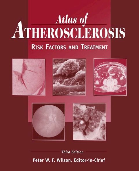 Atlas of Atherosclerosis(Kobo/電子書)