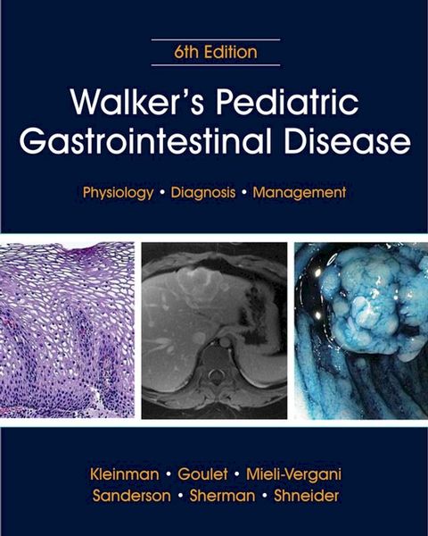 Walker's Pediatric Gastrointestinal Disease(Kobo/電子書)