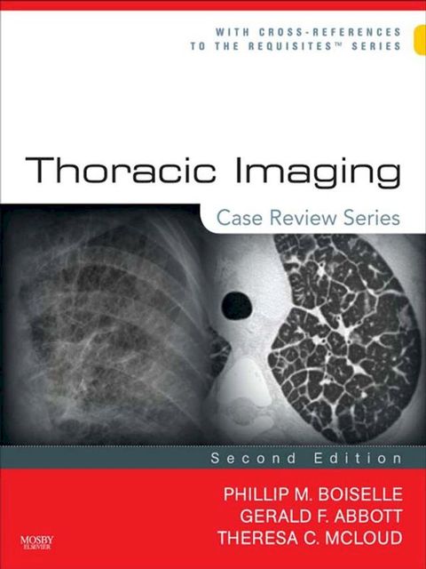 Thoracic Imaging: Case Review Series(Kobo/電子書)