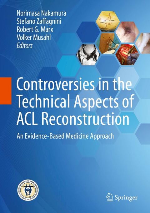 Controversies in the Technical Aspects of ACL Reconstruction(Kobo/電子書)