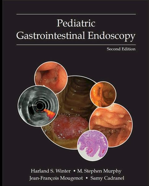 Pediatric Gastrointestinal Endoscopy(Kobo/電子書)