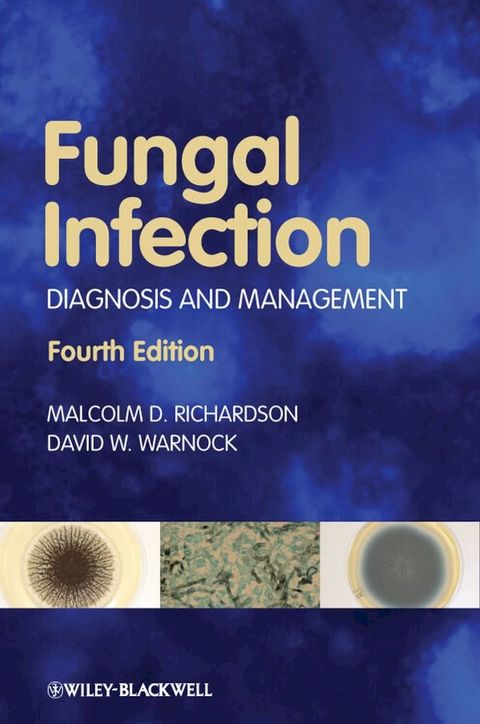 Fungal Infection(Kobo/電子書)