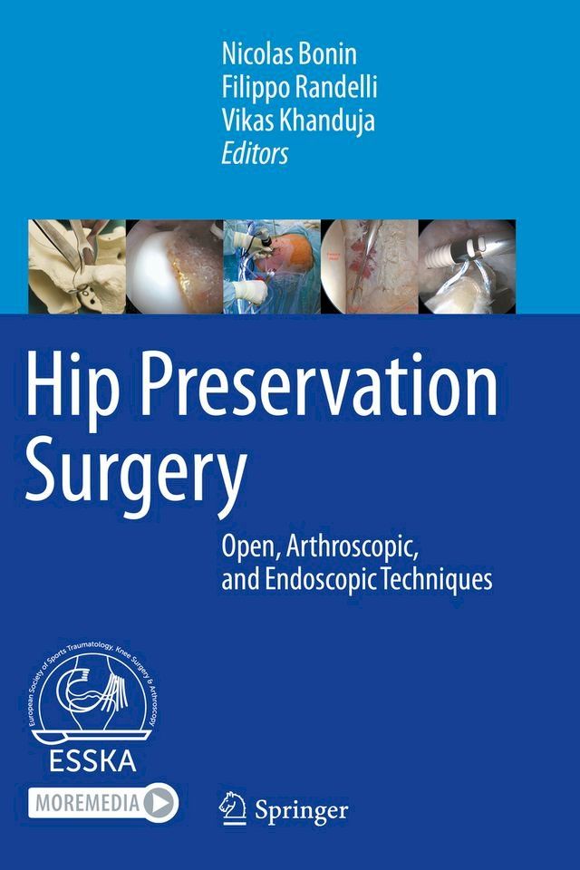  Hip Preservation Surgery(Kobo/電子書)