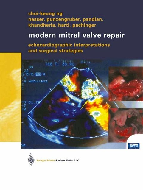 Modern Mitral Valve Repair(Kobo/電子書)