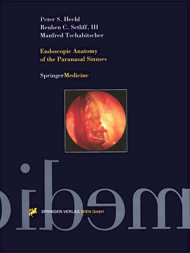  Endoscopic Anatomy of the Paranasal Sinuses(Kobo/電子書)