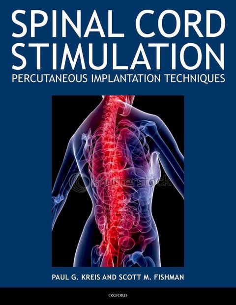 Spinal Cord Stimulation(Kobo/電子書)