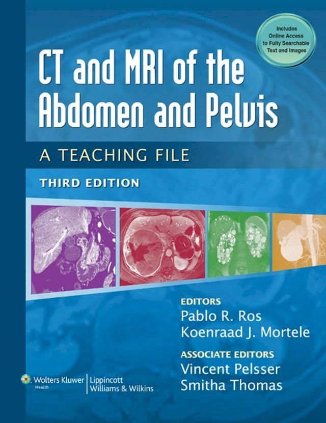  CT & MRI of the Abdomen and Pelvis(Kobo/電子書)