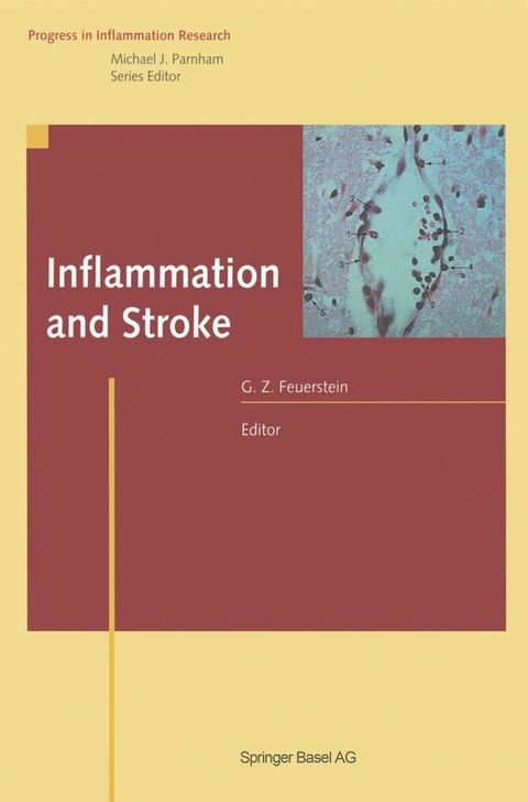 Inflammation and Stroke(Kobo/電子書)