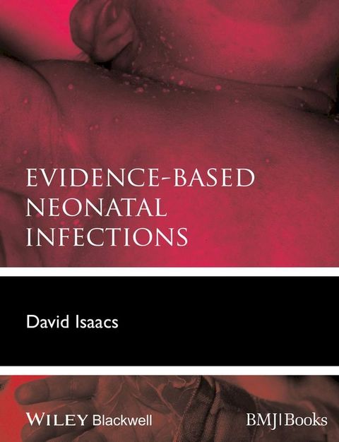 Evidence-Based Neonatal Infections(Kobo/電子書)