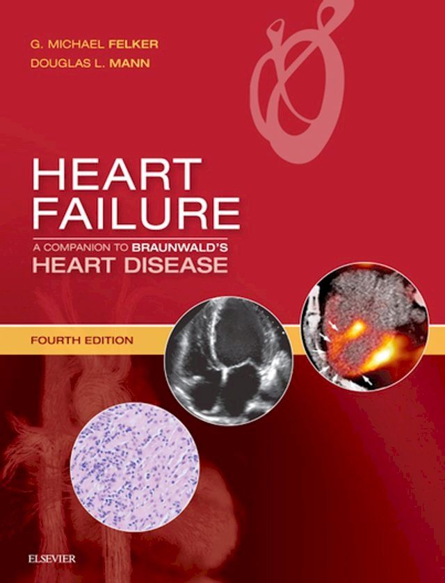  Heart Failure: A Companion to Braunwald's Heart Disease(Kobo/電子書)