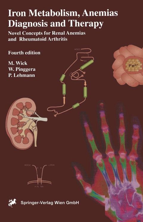 Iron Metabolism, Anemias. Diagnosis and Therapy(Kobo/電子書)