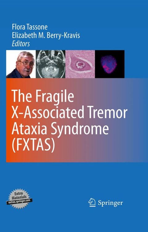 The Fragile X-Associated Tremor Ataxia Syndrome (FXTAS)(Kobo/電子書)