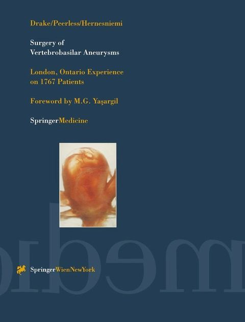 Surgery of Vertebrobasilar Aneurysms(Kobo/電子書)