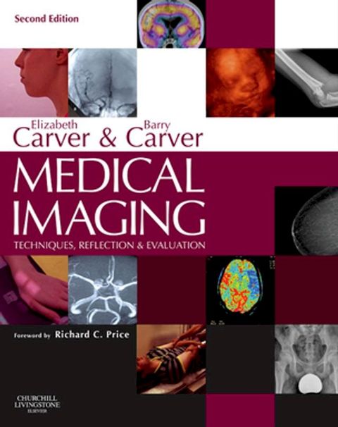 Medical Imaging - E-Book(Kobo/電子書)