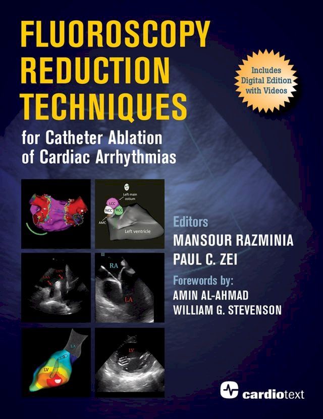  Fluoroscopy Reduction Techniques for Catheter Ablation of Cardiac Arrhythmias(Kobo/電子書)