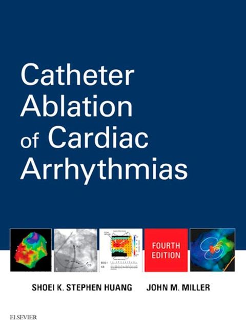 Catheter Ablation of Cardiac Arrhythmias(Kobo/電子書)