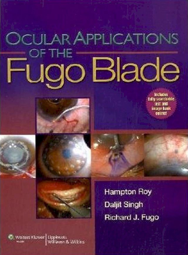  Ocular Applications of the Fugo Blade(Kobo/電子書)