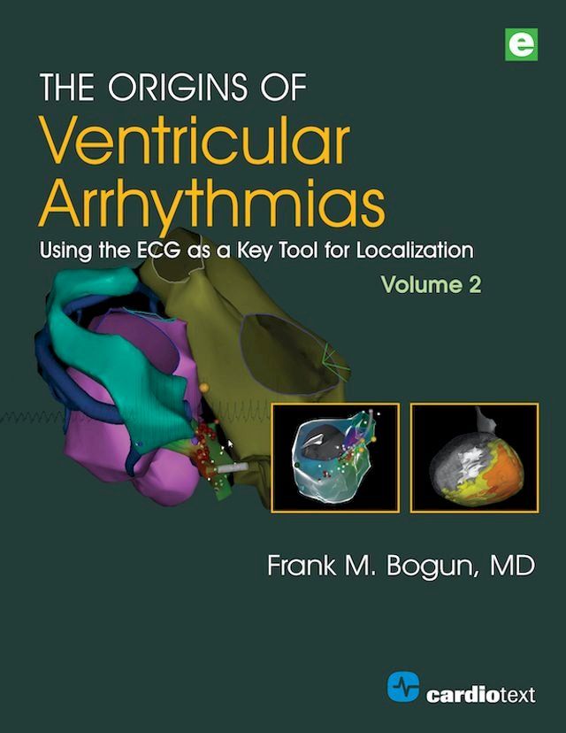  The Origins of Ventricular Arrhythmias, Volume 2(Kobo/電子書)