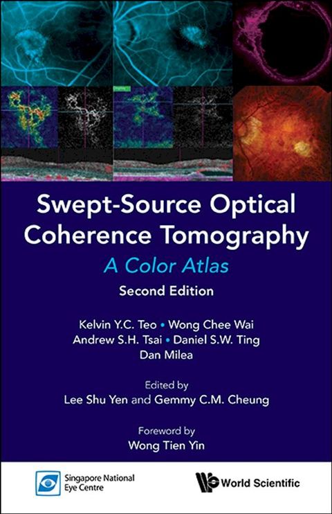 Swept-source Optical Coherence Tomography: A Color Atlas (Second Edition)(Kobo/電子書)