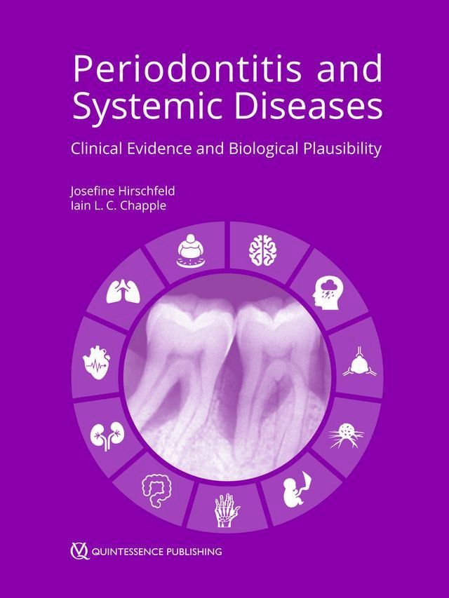  Periodontitis and Systemic Diseases(Kobo/電子書)