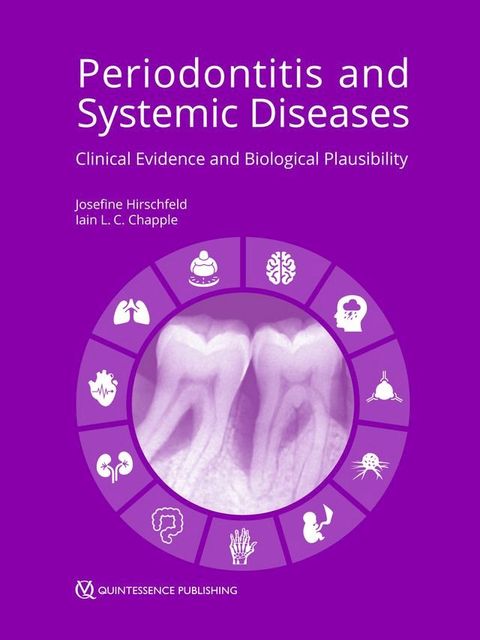 Periodontitis and Systemic Diseases(Kobo/電子書)