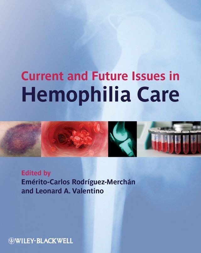  Current and Future Issues in Hemophilia Care(Kobo/電子書)