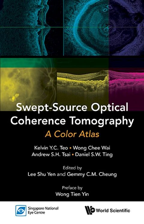 Swept-source Optical Coherence Tomography: A Color Atlas(Kobo/電子書)