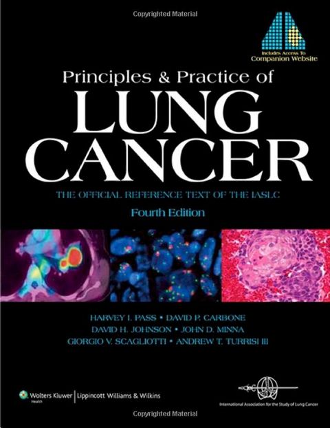 Principles and Practice of Lung Cancer(Kobo/電子書)