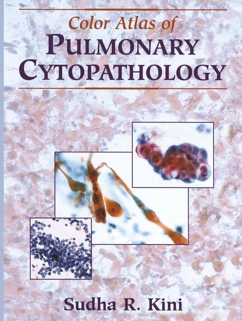 Color Atlas of Pulmonary Cytopathology(Kobo/電子書)