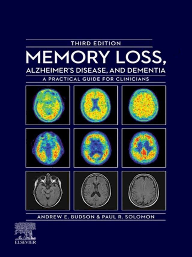  Memory Loss, Alzheimer's Disease, and Dementia(Kobo/電子書)