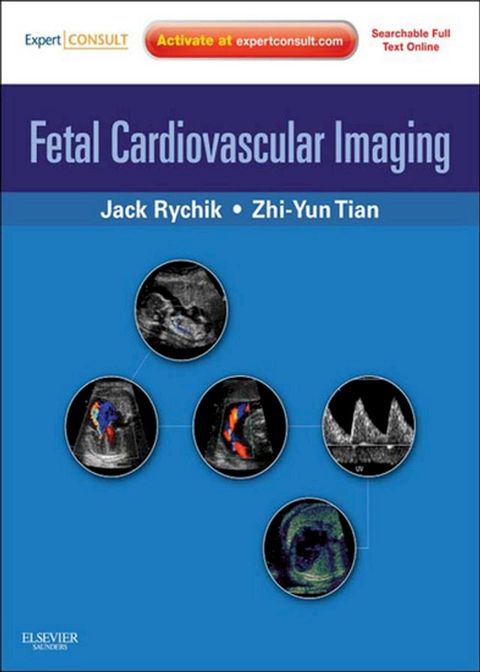 Fetal Cardiovascular Imaging: A Disease Based Approach(Kobo/電子書)