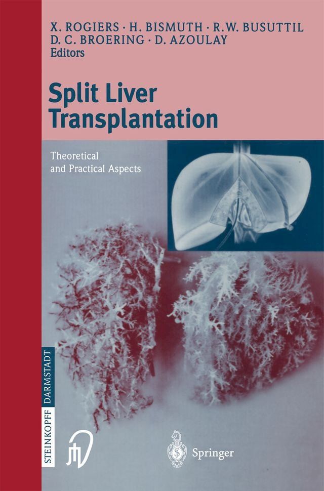  Split liver transplantation(Kobo/電子書)