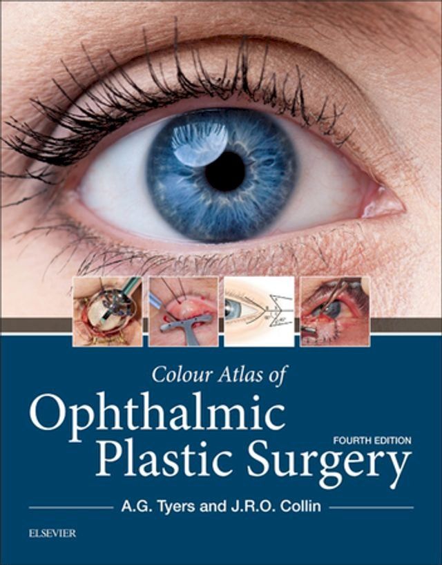  Colour Atlas of Ophthalmic Plastic Surgery E-Book(Kobo/電子書)