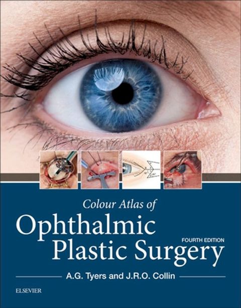 Colour Atlas of Ophthalmic Plastic Surgery E-Book(Kobo/電子書)