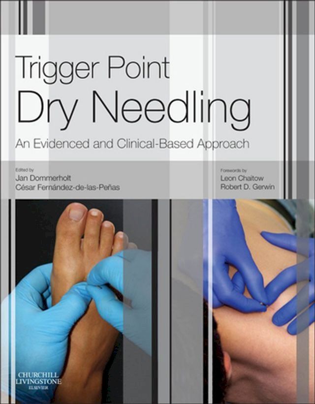  Trigger Point Dry Needling E-Book(Kobo/電子書)