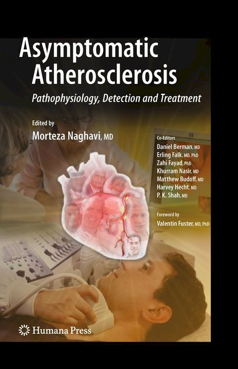 Asymptomatic Atherosclerosis(Kobo/電子書)