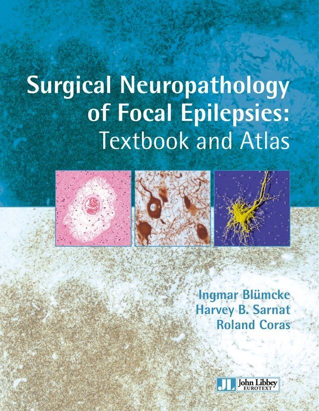  Surgical neuropathology of focal epilepsies(Kobo/電子書)