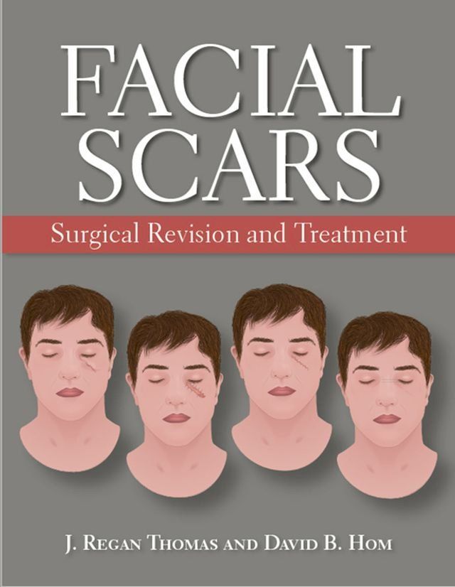  Facial Scars(Kobo/電子書)