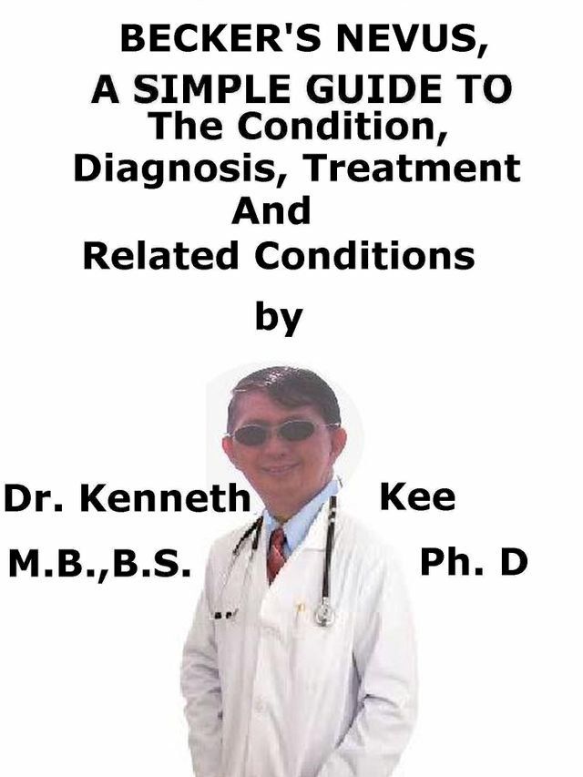  Becker’s Nevus, A Simple Guide To The Condition, Diagnosis, Treatment And Related Conditions(Kobo/電子書)