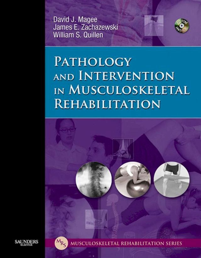  Pathology and Intervention in Musculoskeletal Rehabilitation - E-Book(Kobo/電子書)