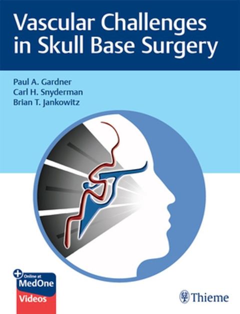 Vascular Challenges in Skull Base Surgery(Kobo/電子書)