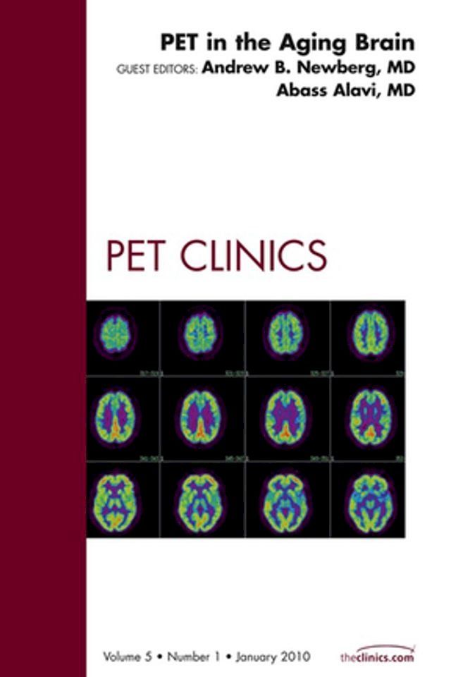  PET in the Aging Brain, An Issue of PET Clinics(Kobo/電子書)